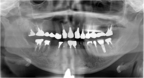 石川５　上部構造装着後